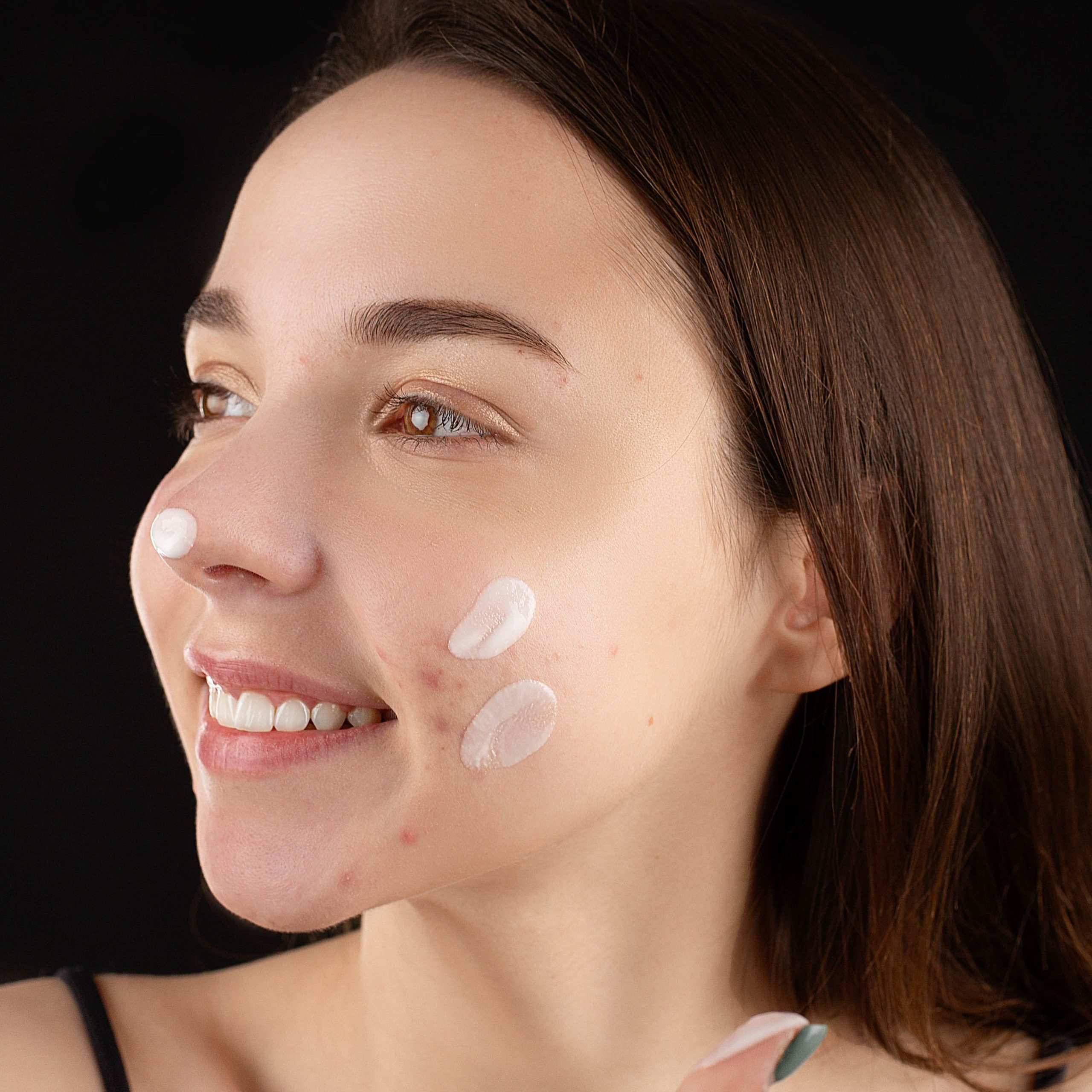 Remove Pimples Naturally and Permanently